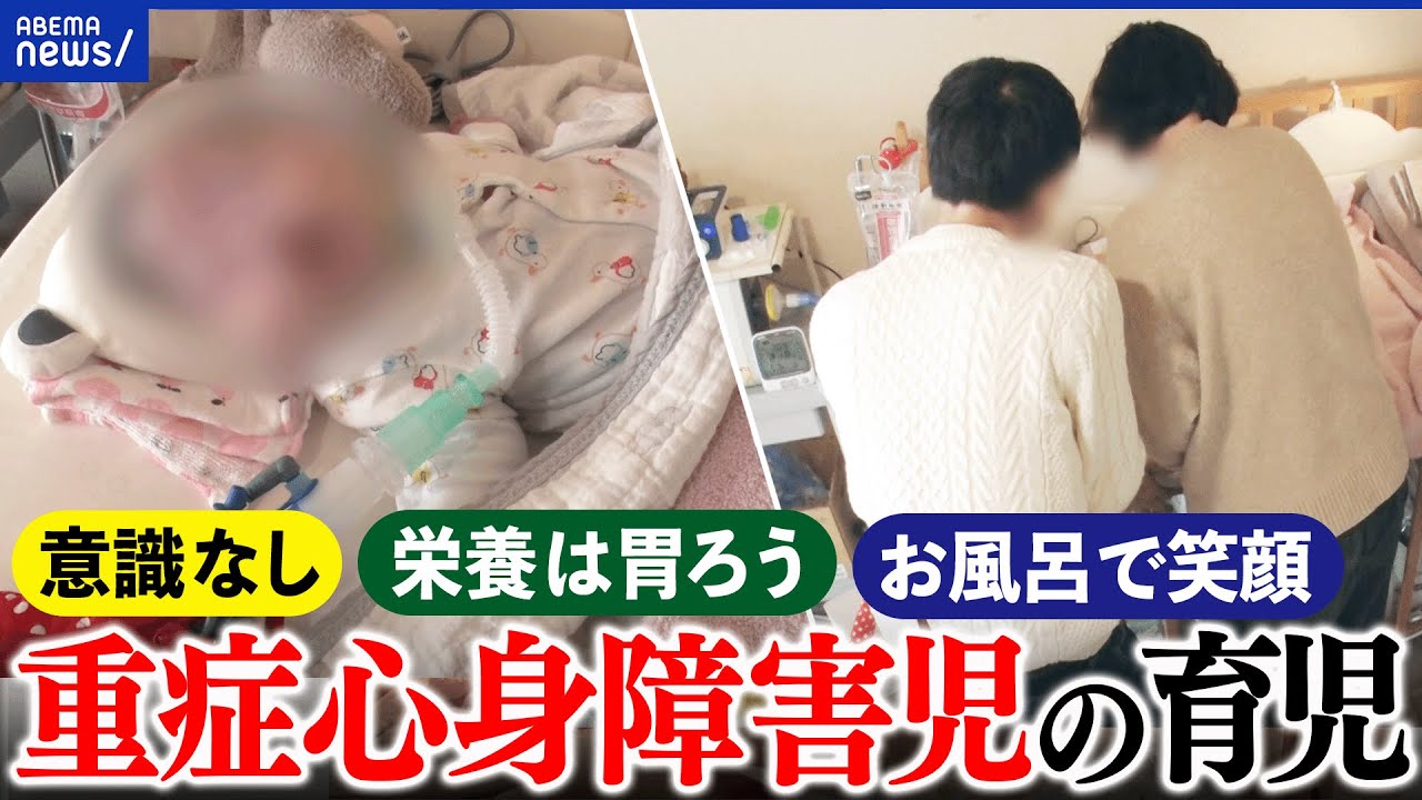 【重症心身障害児】24時間ケアする夫婦の日常は？親の息抜きは？