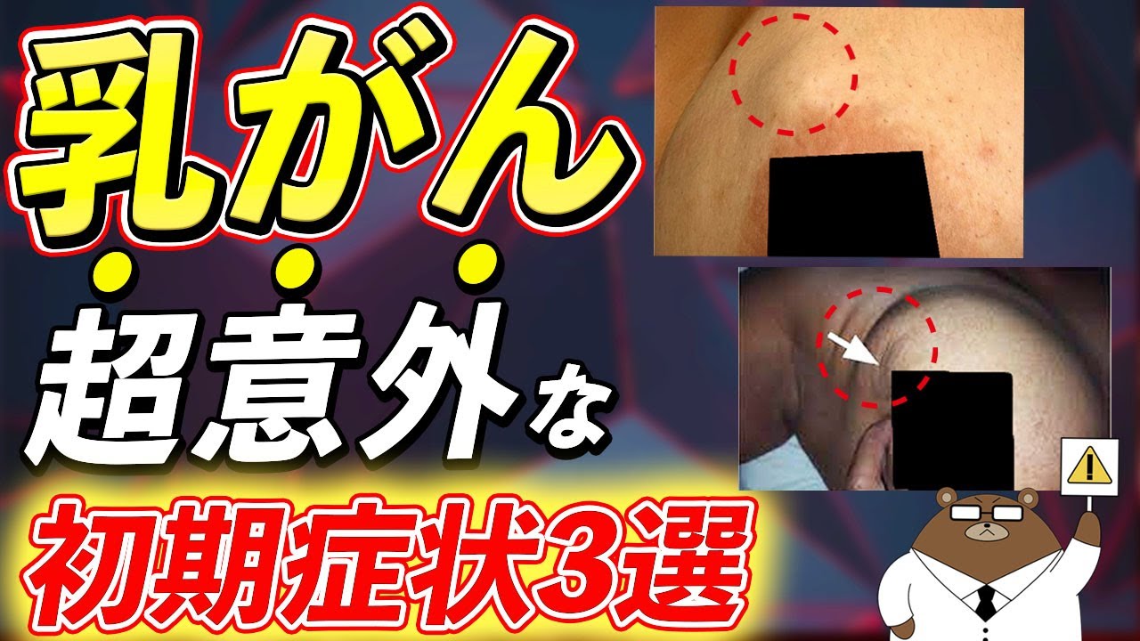 【40代・50代必見】放置厳禁！絶対に見逃さないで！知らないと後悔する乳がんの危険サインとは？予防法は存在するの？