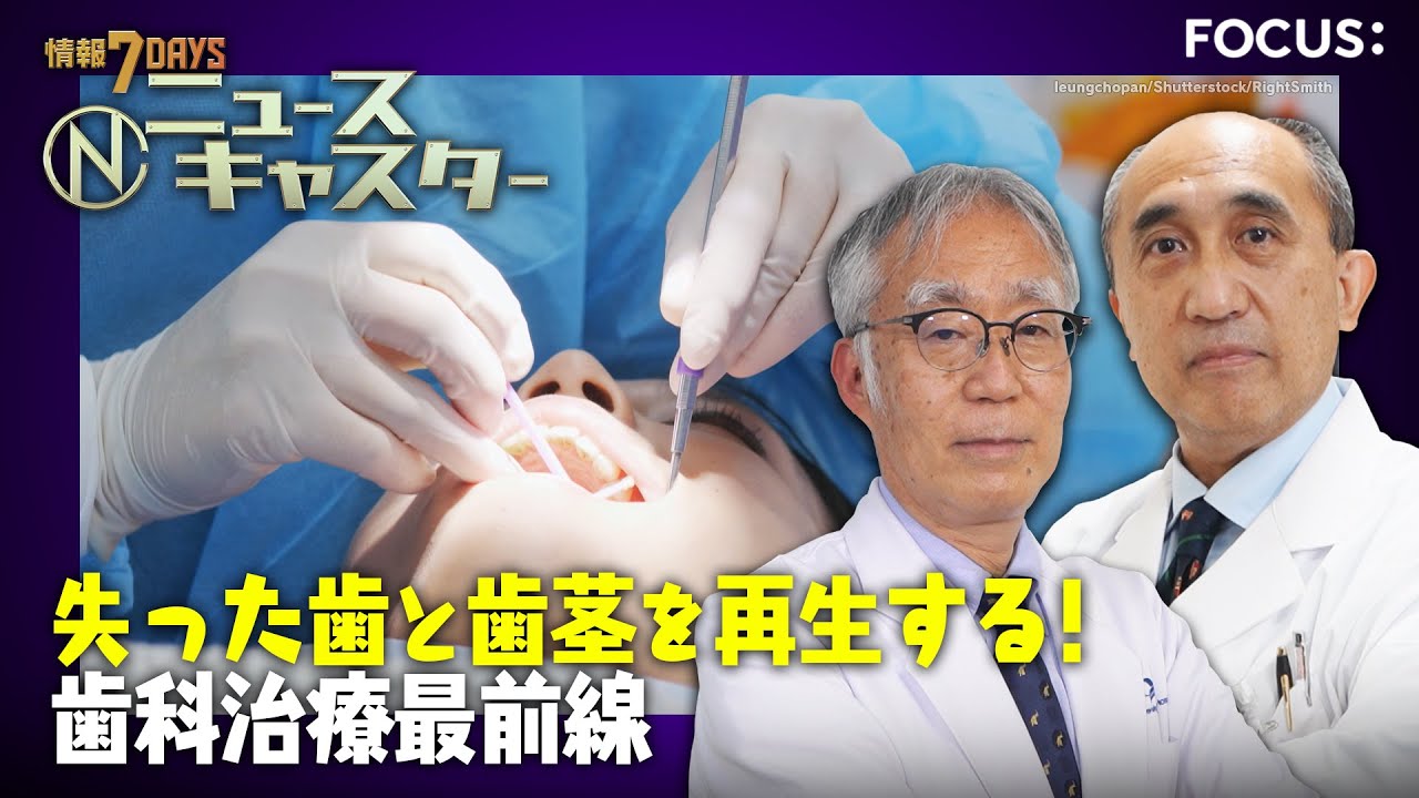 【情報7daysニュースキャスター】 FOCUS：歯と歯茎を再生する！歯科治療最前線