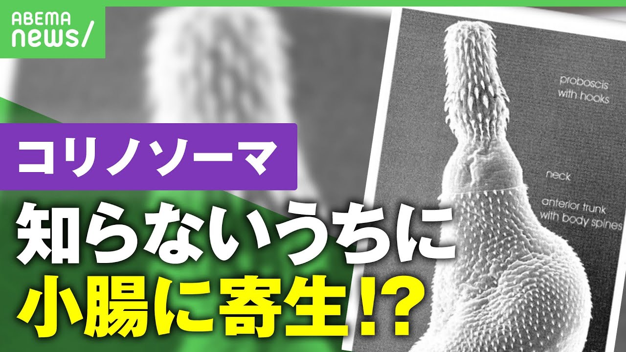 【寄生虫】アニサキスの次は｢コリノソーマ｣？一部の魚の生食で小腸に寄生…発見が困難で知らずに"飼い主"になる可能性も