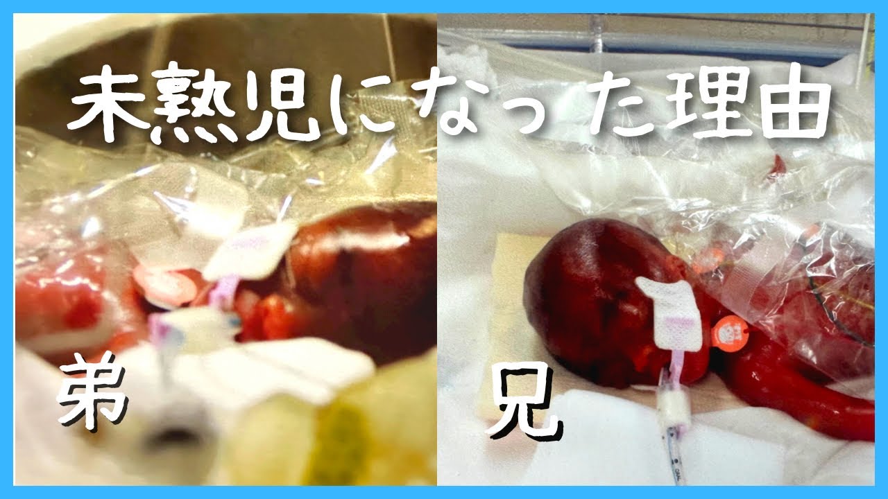 未熟児 超低出生体重児になった理由 双子妊娠 出産