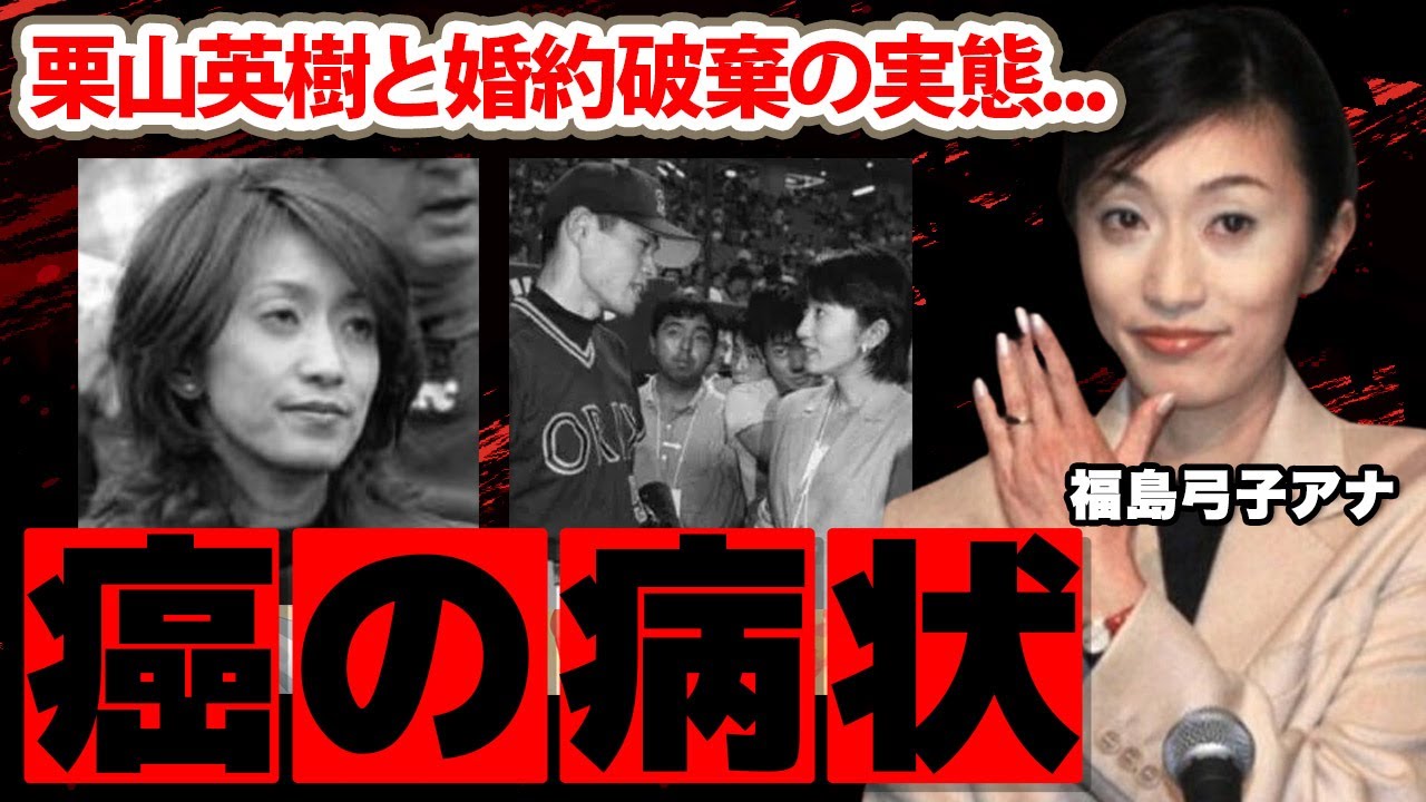 福島弓子アナが栗山英樹と結婚間近で婚約破棄をした真相に驚愕！「玉の輿ではなく...」夫のイチローと子供がいない理由や現在が癌と言われる理由や職業に衝撃の嵐！【TBS】