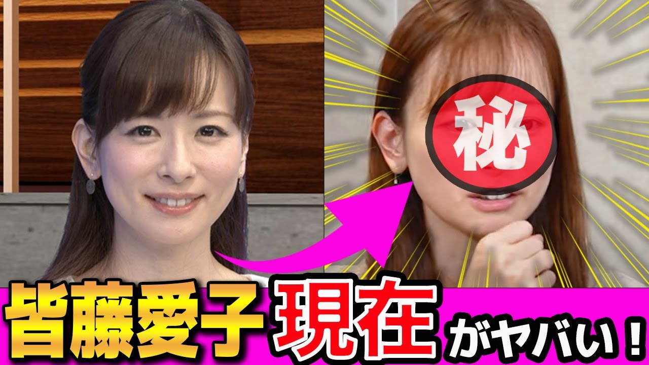 皆藤愛子の現在の姿や活動内容に一同驚愕…！『めざまし』女子アナを襲った難病や結婚の真相に驚きを隠せない…！