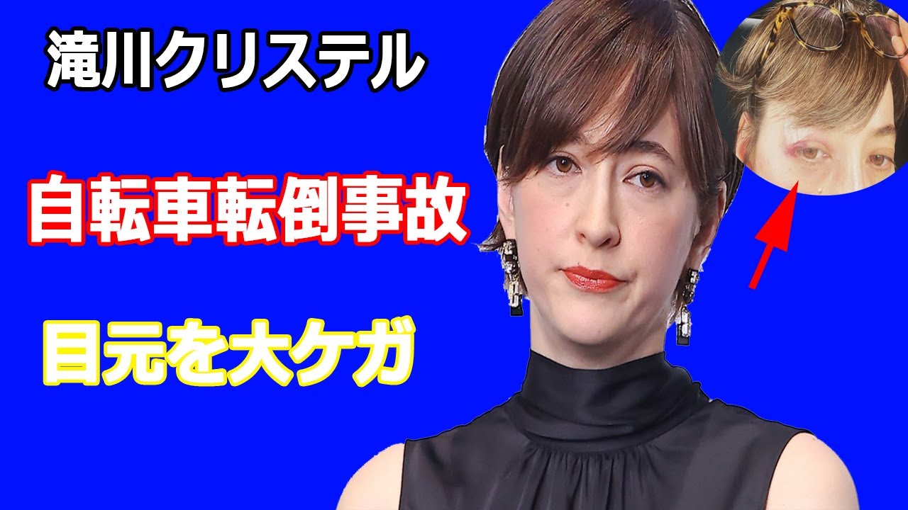 滝川クリステルが自転車のヘルメット着用努力義務化直後にトラブル。目元を大ケガ
