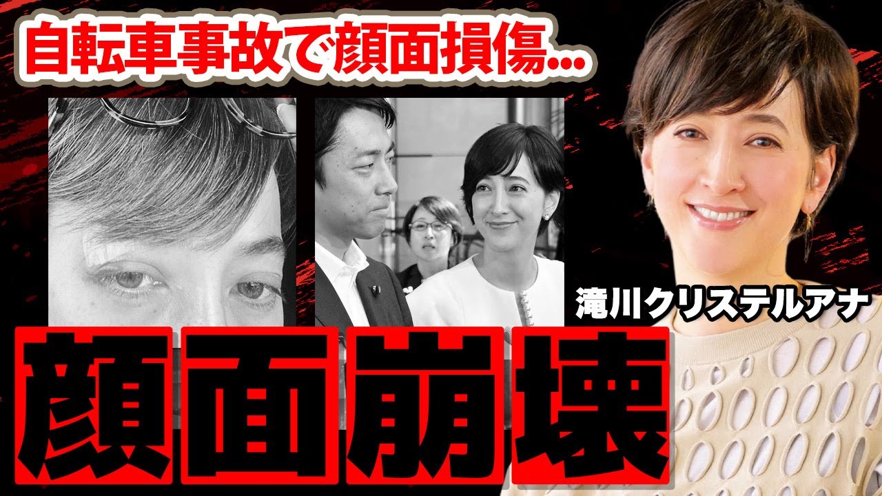 滝川クリステルアナの事故の真相...10数針縫う顔面崩壊の現在に驚愕！「い・た・す・ぎ・る」夫・小泉進次郎と離婚間近と言われる理由に衝撃の嵐！【ニュースJAPAN】