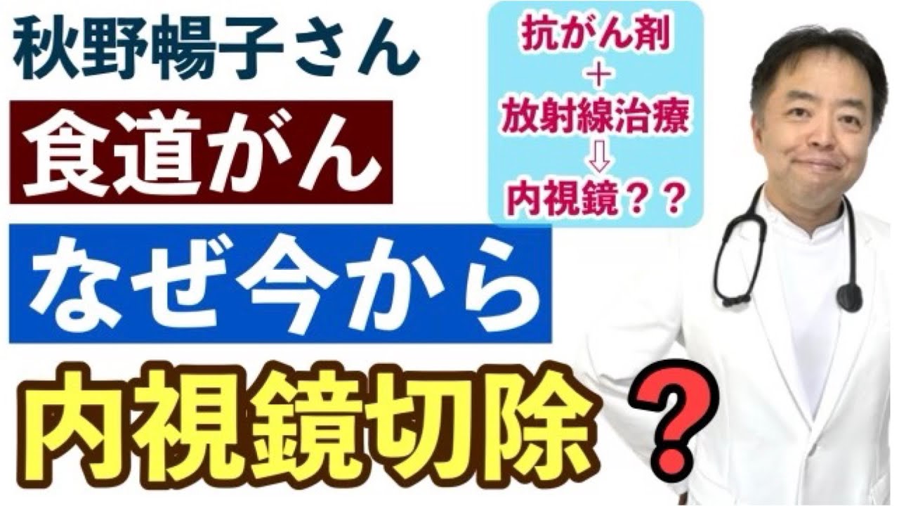 秋野暢子さんの食道がんでなぜ今から内視鏡治療？【専門医が解説】・有名人がん解説シリーズ