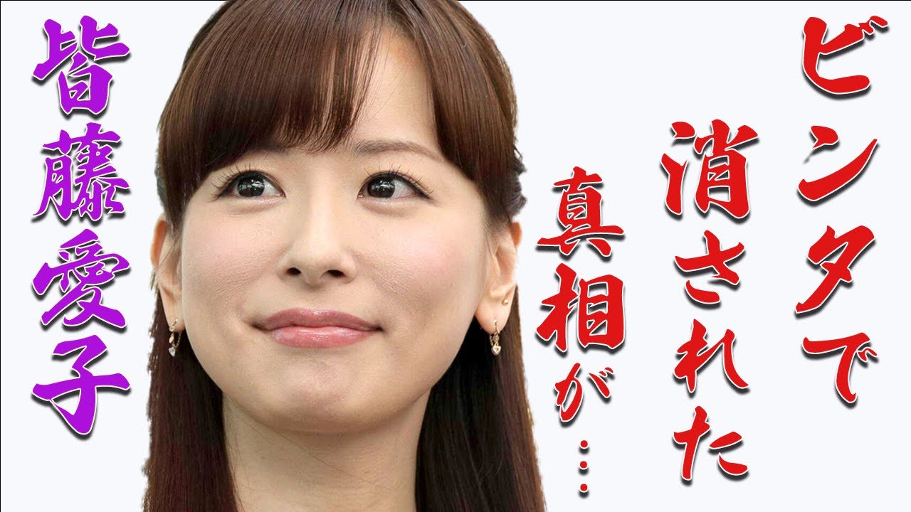 皆藤愛子がテレビから消えた理由に驚きを隠せない。たった一言でスタッフからビンタ？！めざましテレビのお天気キャスターの病気と現在に涙が止まらない…