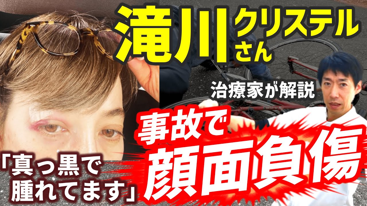 【滝沢クリステル】自転車事故で顔面負傷/打撲の治り方を解説
