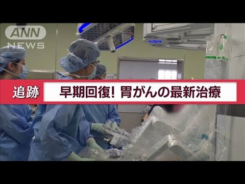 胃がんの最新治療　「歯科検診」に「ジム通い」…「チーム医療」で目指せ“早期回復”【Jの追跡】(2023年4月24日)