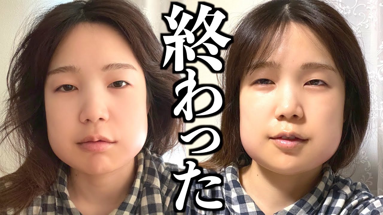 入院して手術しました。