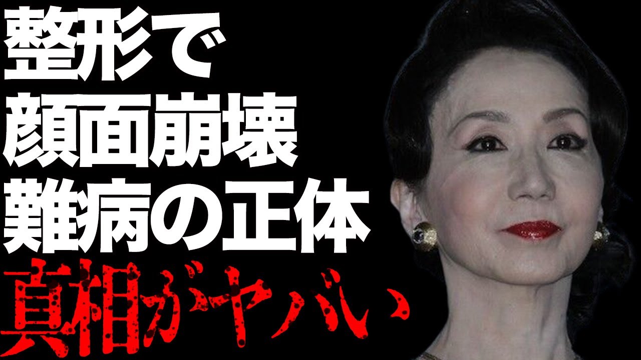 岩下志麻の整形で顔面崩壊したと言われる現在の姿に言葉を失う…「極道の妻たち」に出演していたことでも有名な女優の難病の正体に驚きを失う…