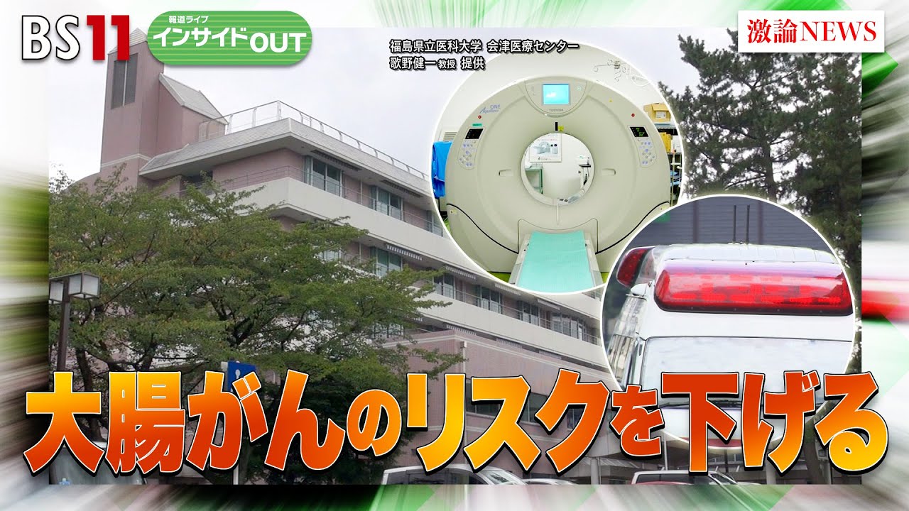 【警鐘】大腸がん 食生活と運動でリスクを軽減　　ゲスト：小泉 浩一（東京都立多摩北部医療センター 副院長）、須藤 明治（国士舘大学 体育学部教授）5月3日（水）BS11 報道ライブインサイドOUT