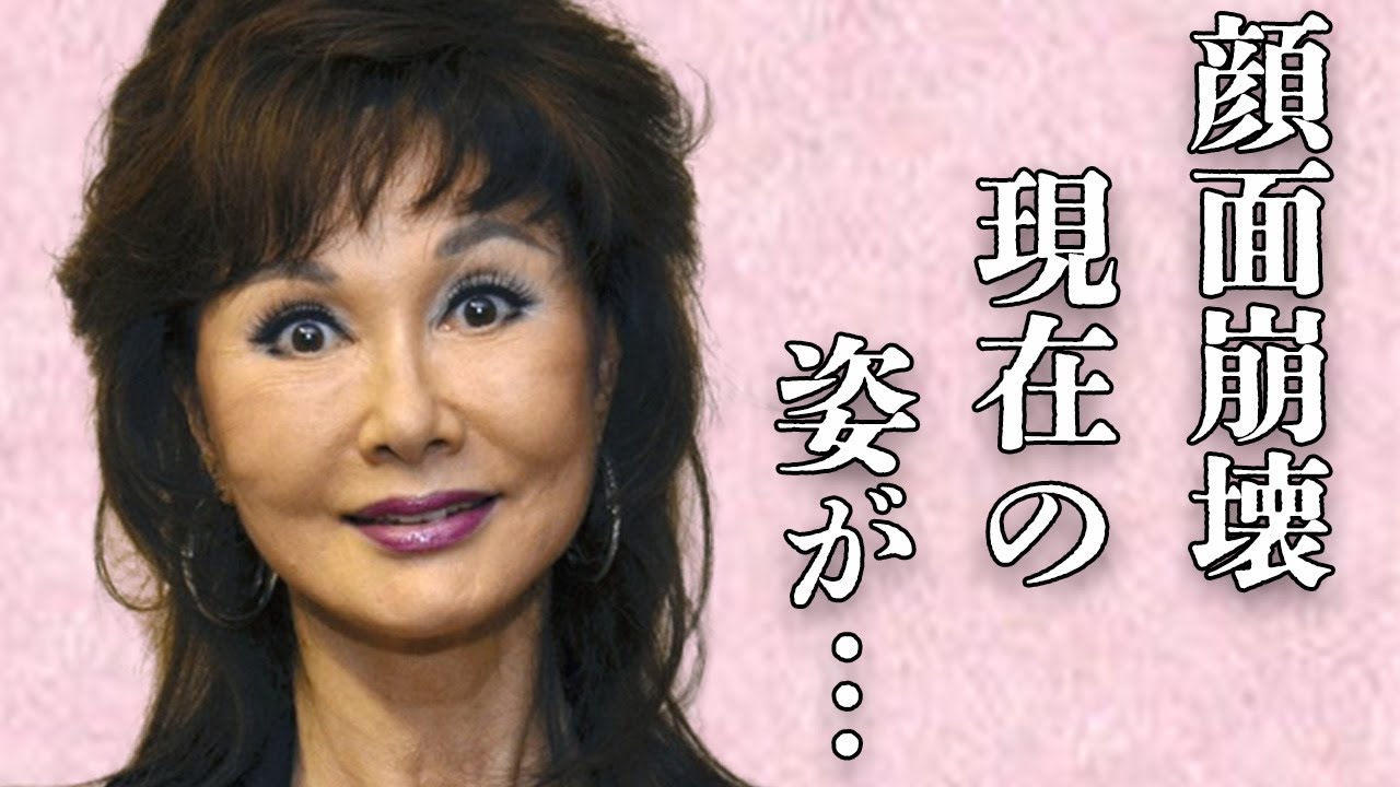 山本リンダの整形のしすぎで“顔面崩壊”した現在の姿や“熟年結婚”の真相に言葉を失う…「どうにもとまらない」でも有名な歌手の旦那の職業や馴れ初めに驚きを隠せない…