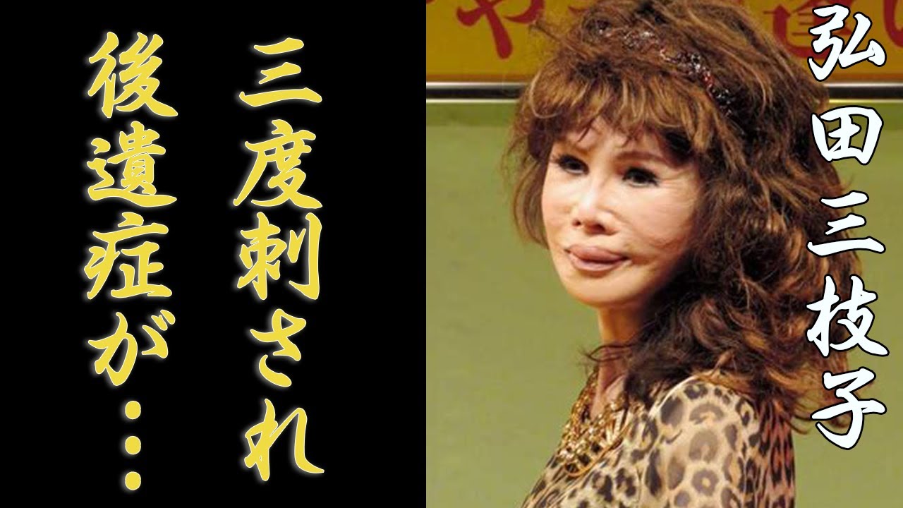 弘田三枝子が三度刺された後遺症と戦った生涯...突然の訃報に涙が零れ落ちた...「和製ブレンダ・リー」の愛称で有名な紅白歌手の禁断の恋を続けた末路...顔面崩壊と言われた晩年に驚きを隠せない...