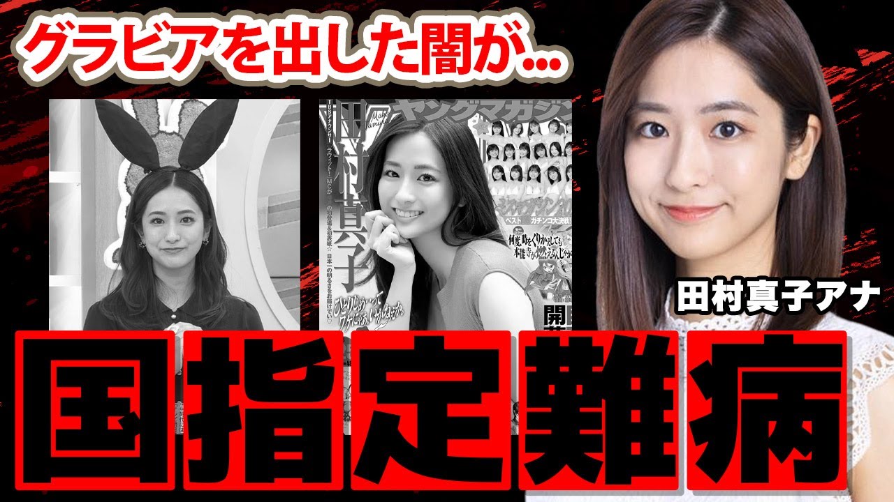 【ラヴィット】田村真子アナの国指定難病の真相に驚愕！『結婚については...』クリーン女子アナがグラビアに挑戦した闇深い理由に衝撃の嵐！【TBS】