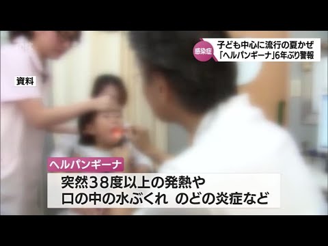 子ども中心に流行する夏風邪「ヘルパンギーナ」　６年ぶりに宮崎県内で警報レベル超える　新型コロナ前週比1.43倍　インフルエンザ前週比1.56倍