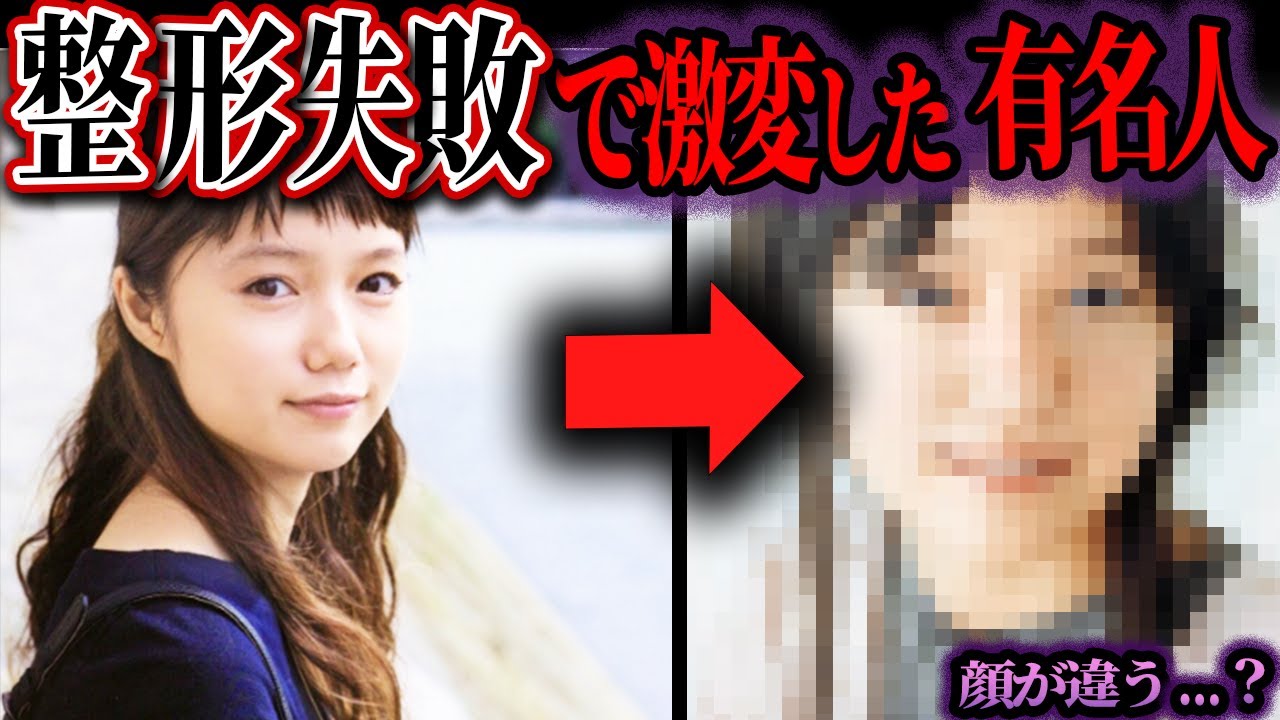 【ゆっくり解説】整形で失敗…？顔が激変してしまった噂の芸能人・有名人