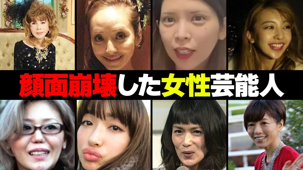 顔面崩壊した芸能人・有名人１７選