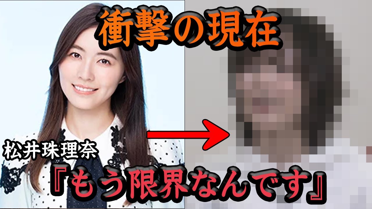 松井珠理奈の現在の姿に驚愕…『このまま引退も視野に…』SKEのエースとして君臨して現在も休業中のメンバーの本音が闇深すぎた【アイドル】