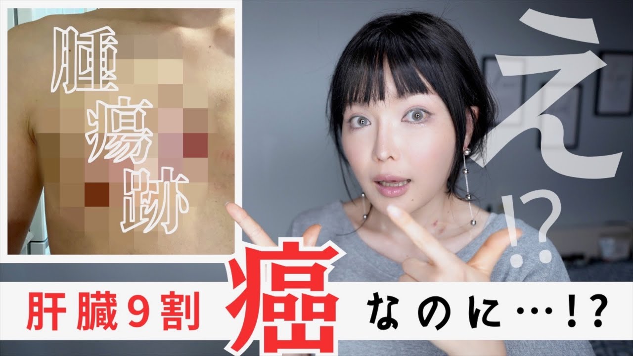 【乳がん/ 抗がん剤治療2クール目】主治医が驚いた検査結果！