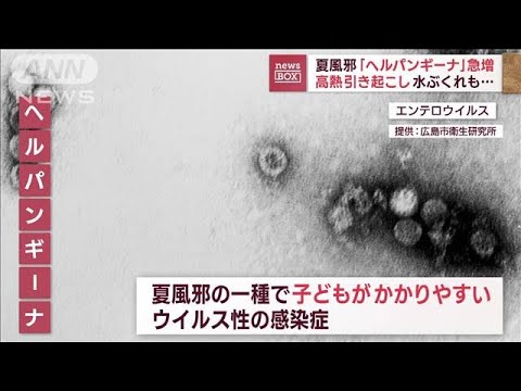 夏風邪「ヘルパンギーナ」急増　高熱引き起こし、水ぶくれも(2023年6月30日)