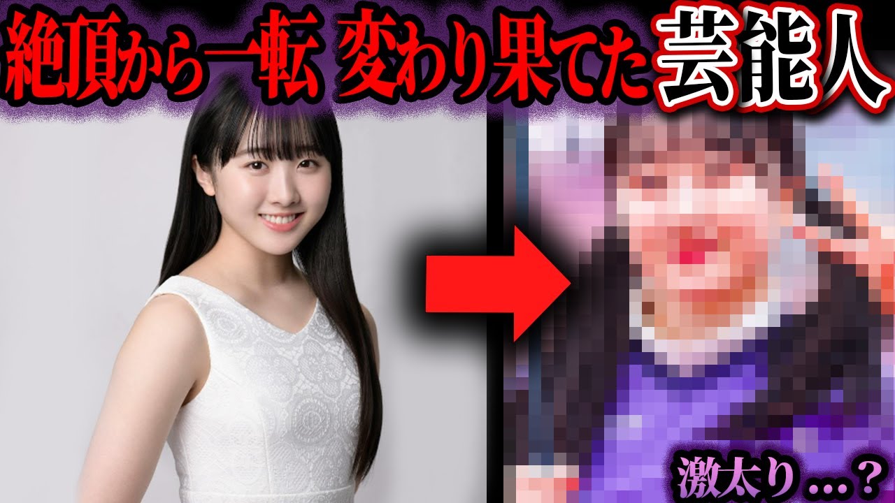 【ゆっくり解説】衝撃の末路…変わり果てた姿に変わってしまった芸能人たち…整形