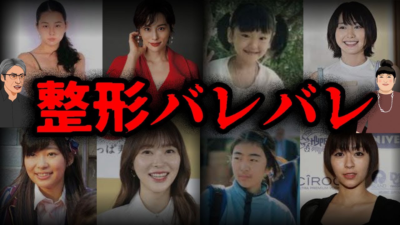 【もはや別人】昔と顔が違いすぎて整形バレバレな芸能人7選【ゆっくり解説】