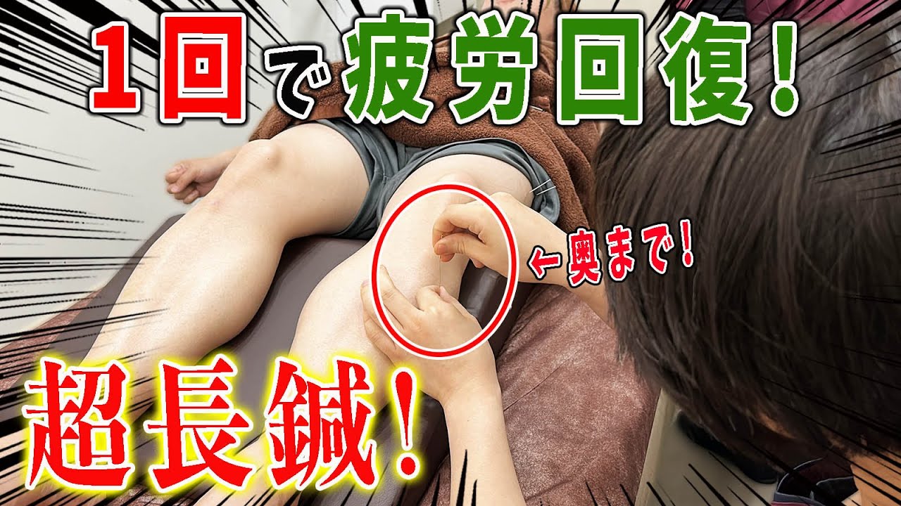 【鍼治療】たった1回の鍼治療で疲労を一気に回復！刺激的な美容鍼灸王子の鍼が凄すぎる！【@uwasa-no-canna 】
