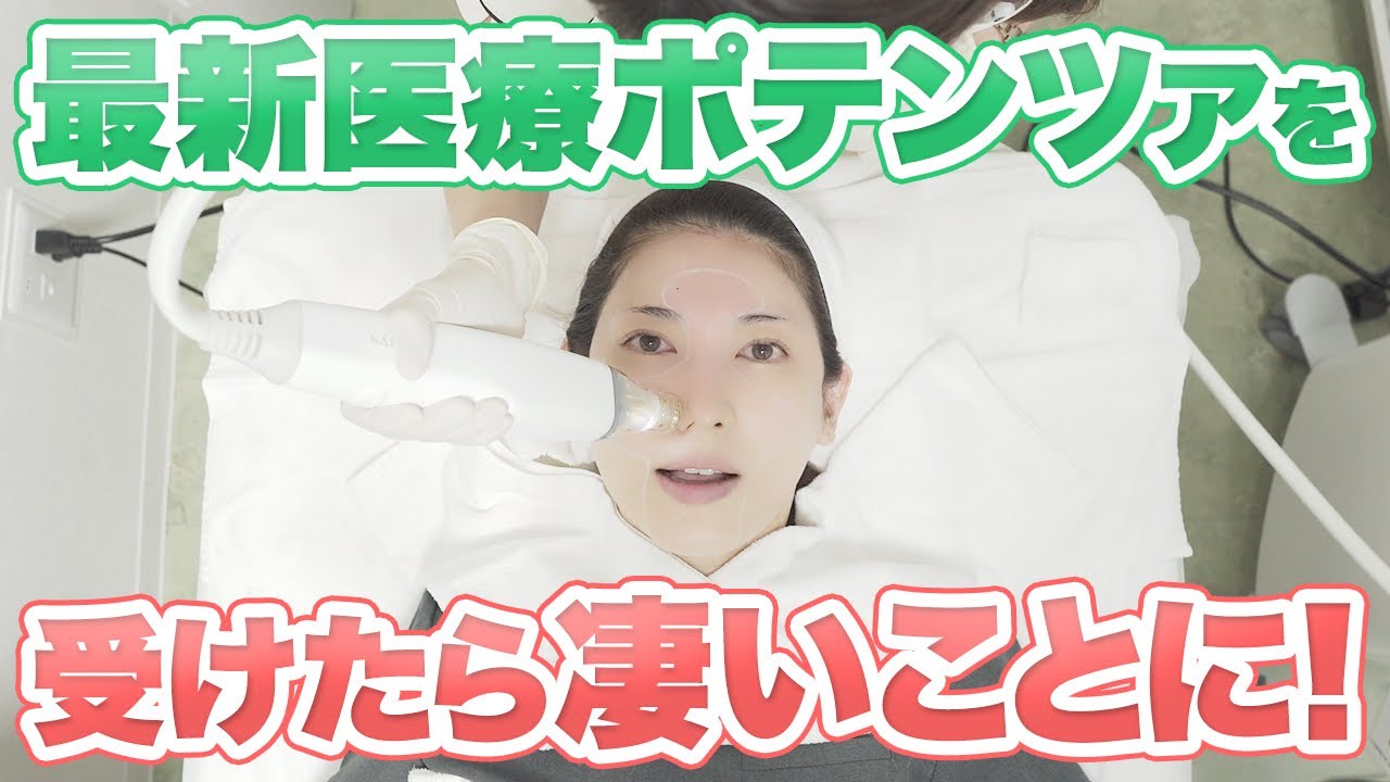 【肌を綺麗にする方法】最新治療の「ニードルRFポテンツァ」受けてみたらスゴすぎました！