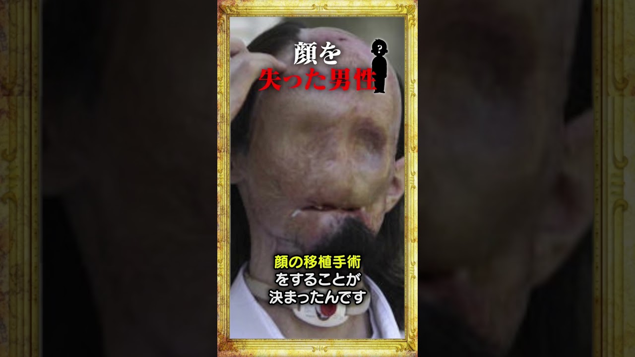顔を失った男性、、、？！#雑学 #shorts