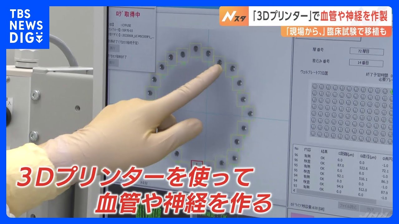 3Dプリンターで「血管」「神経」を作製！？臨床試験で移植も実施…“夢の治療法”に迫る｜TBS NEWS DIG