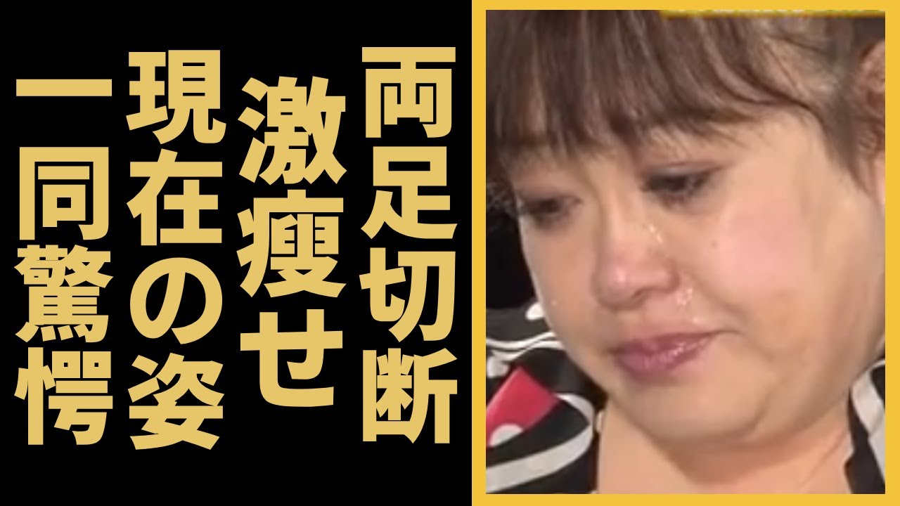 森公美子に降り掛かった悲劇の真相や現在の両足切断の姿に涙が止まらない...オペラ歌手「モリクミ」が交通事故で頭部を強打、12年間も言葉を話せず...車椅子生活を介護し続ける姿に涙が溢れる...