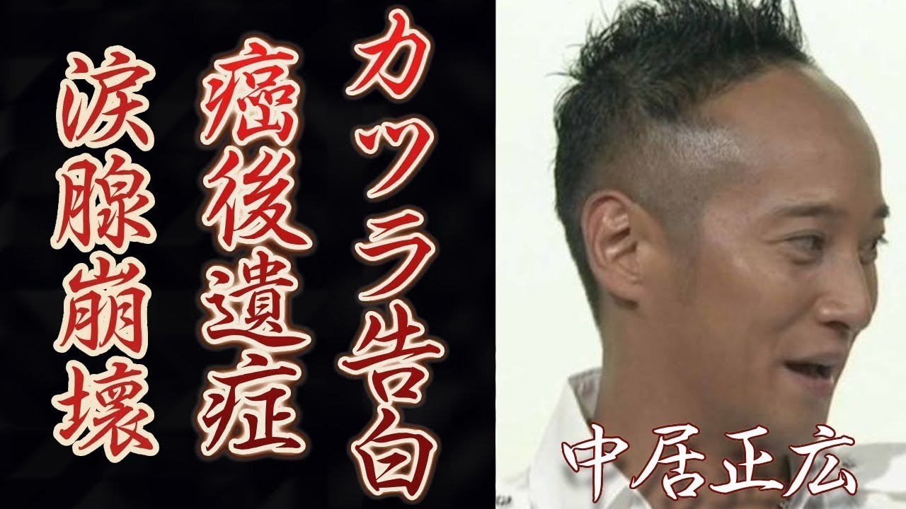 中居正広がカツラを被っていたことを告白...ガン闘病の後遺症に涙が零れ落ちた...多くの人気番組のＭＣを務める元アイドルが今尚"病名"を隠し続ける理由がヤバすぎた...