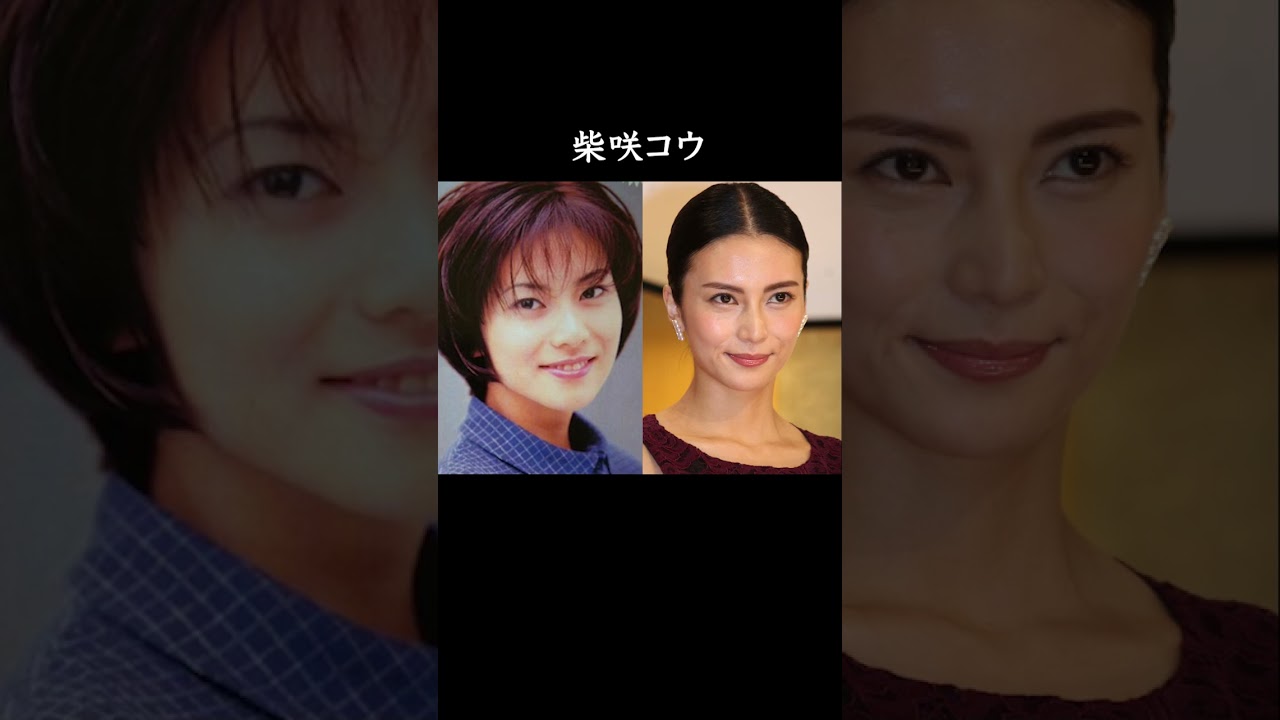 整形が噂されるほど美人になった芸能人10選