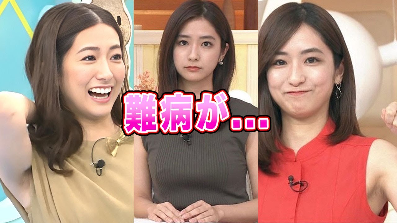 【TBS】田村真子アナが患う国指定の難病がヤバすぎる！美人アナウンサーの極秘彼氏の正体に一同驚愕！