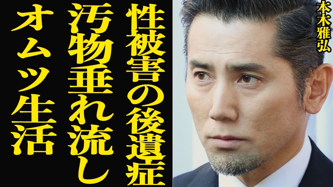 シブがき隊の本木雅弘がオムツを手放せない現在を告白で思わず絶句…ほぼ垂れ流し状態でスタッフ困惑、後遺症に悩む現在と必死の訴えに驚きを隠せない【芸能】