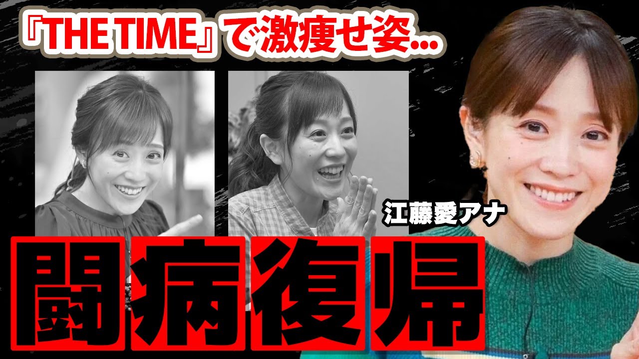 【TBS】江藤愛アナのひと月ぶりの復帰も深刻すぎる抱える病気や退社間近の真相に驚愕！『THE TIME』で活躍する女子アナの現在の彼氏の正体に衝撃の嵐！
