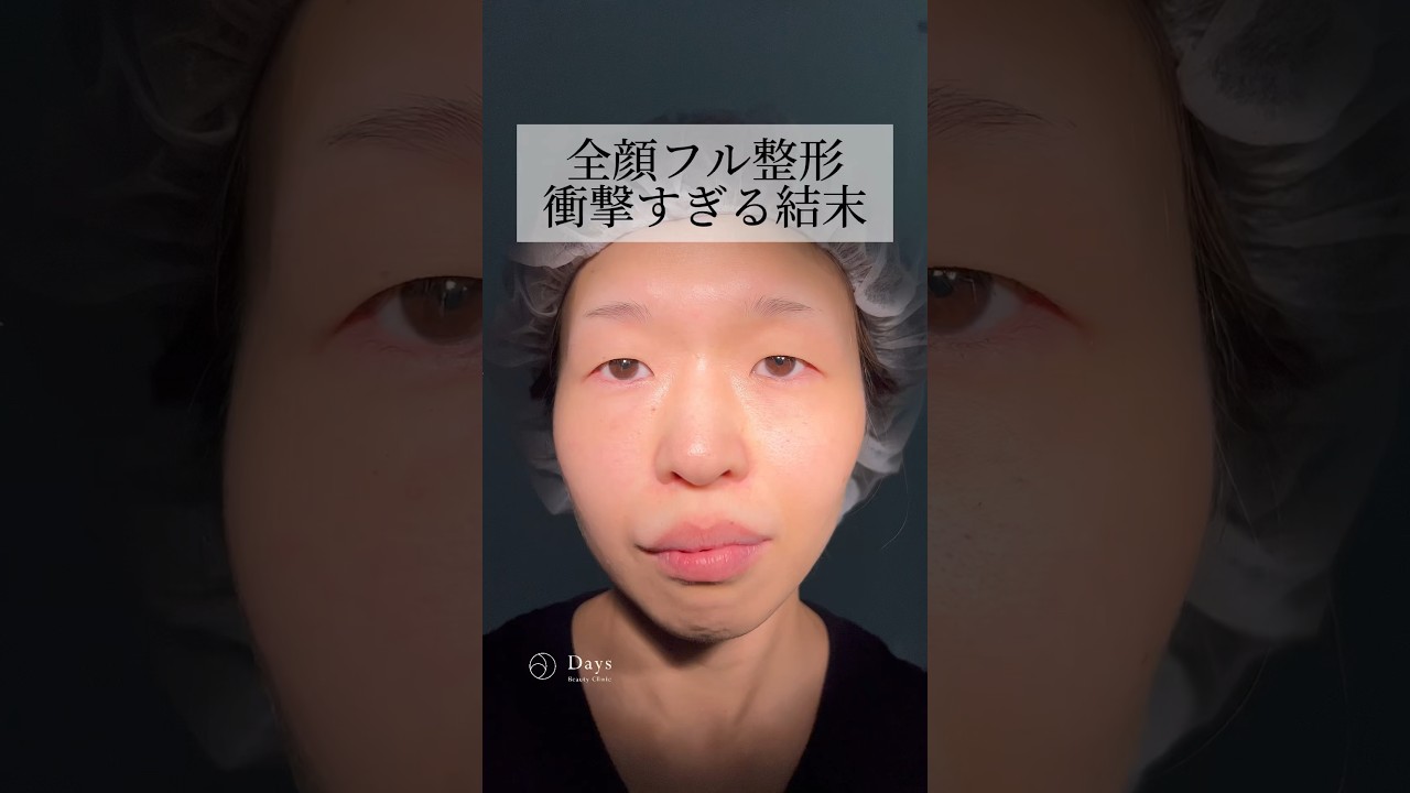 【全顔フル整形】衝撃すぎる結末…！#shorts