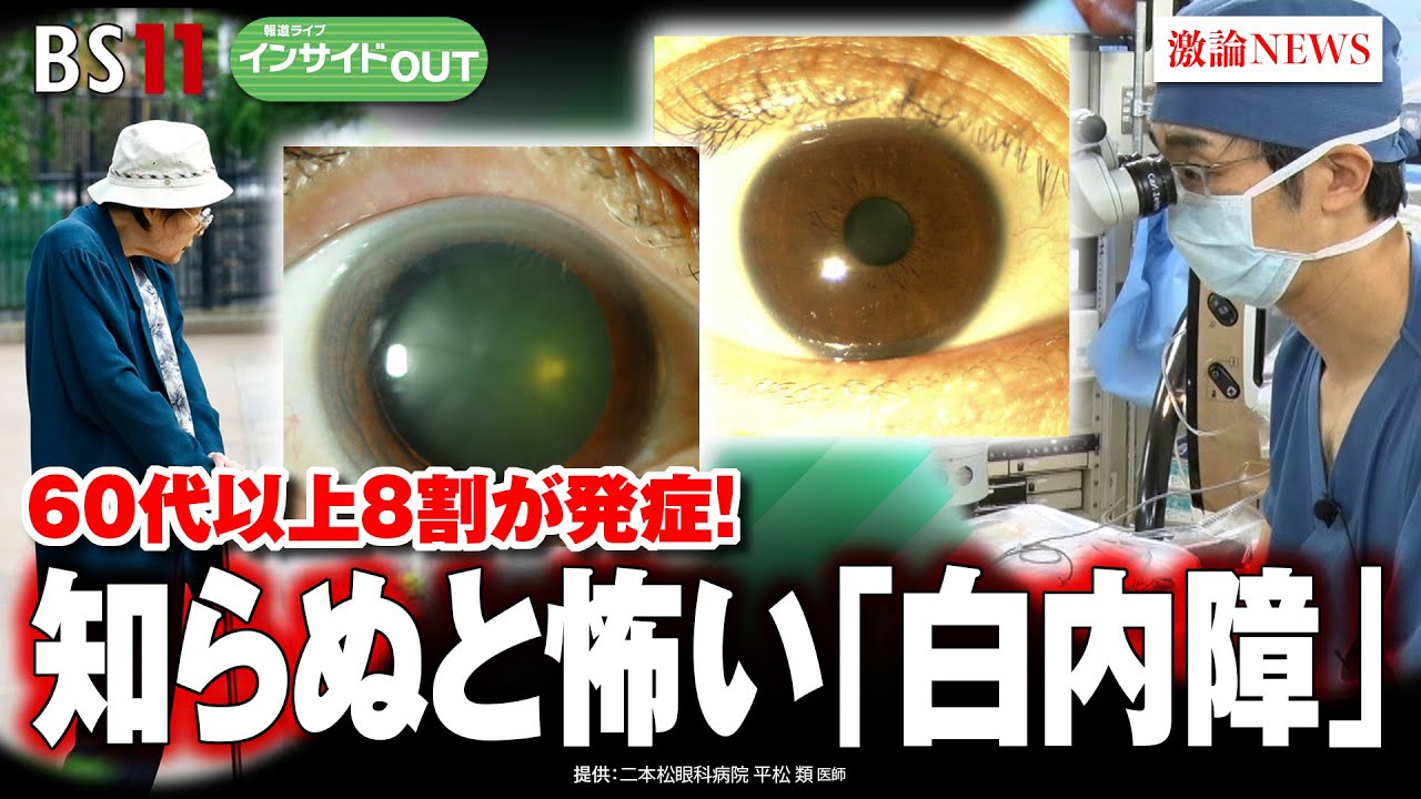 【知らぬと怖い「白内障」】60代以上の8割が発症！ 　ゲスト：平松類（二本松眼科病院副院長）、木原洋美（医療ジャーナリスト）11月23日（木）BS11　報道ライブインサイドOUT