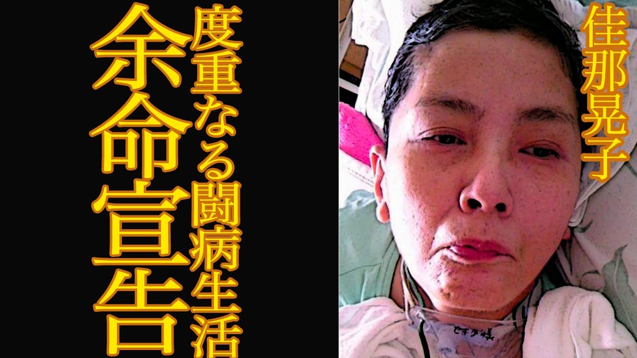 【衝撃】佳那晃子の現在の病状が●●すぎてヤバい…夫との懸命のリハビリの様子に一同涙なしでは見れない…【芸能】