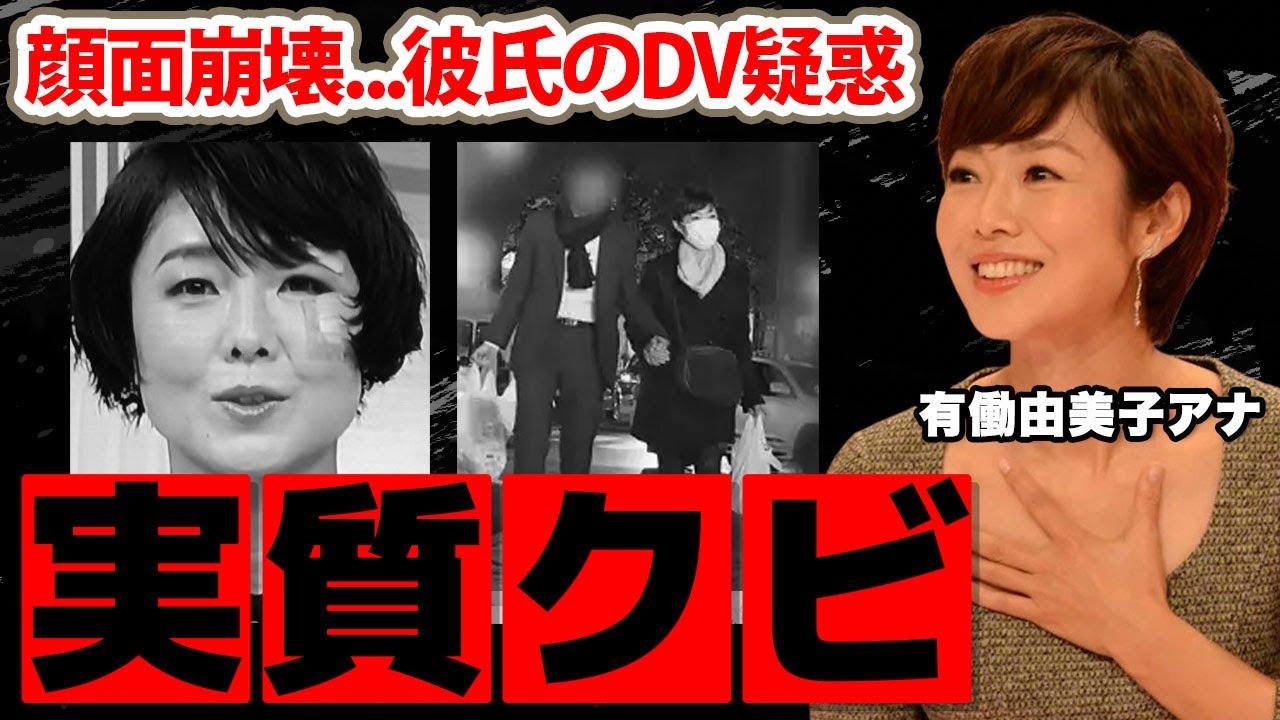 【news zero】有働由美子アナの降板が実質クビの真相...大怪我で顔面崩壊した本当の理由に驚愕！熱愛彼氏のＤＶ疑惑の実態がヤバすぎた！【日本テレビ】