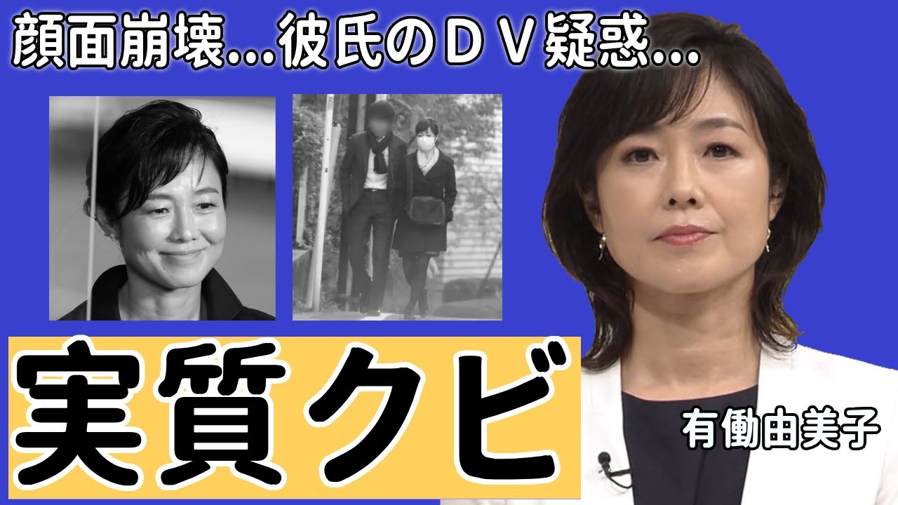 有働由美子アナの降板が実質クビの真相...突然襲った大怪我で顔面崩壊した現在に一同驚愕...！暴露された熱愛彼氏のＤＶ疑惑の実態に驚きを隠さない...