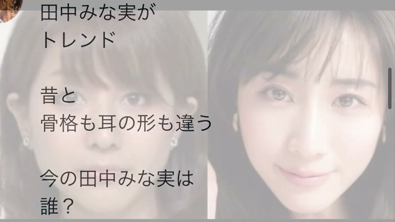 【亀梨和也さんと交際結婚報道】田中みな実さんの顔が違う