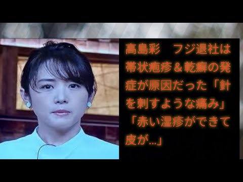 高島彩　フジ退社は帯状疱疹＆乾癬の発症が原因だった「針を刺すような痛み」(japan newz)「赤い湿疹ができて皮が…」