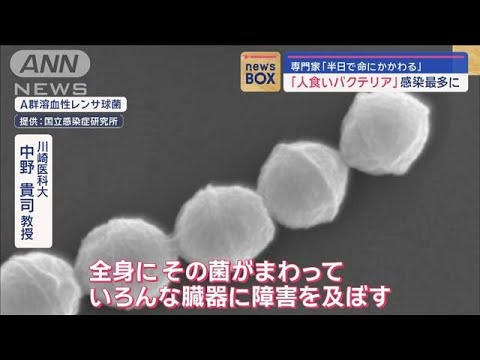 “人食いバクテリア”感染最多に　専門家「半日で命にかかわる」【スーパーJチャンネル】(2024年1月18日)
