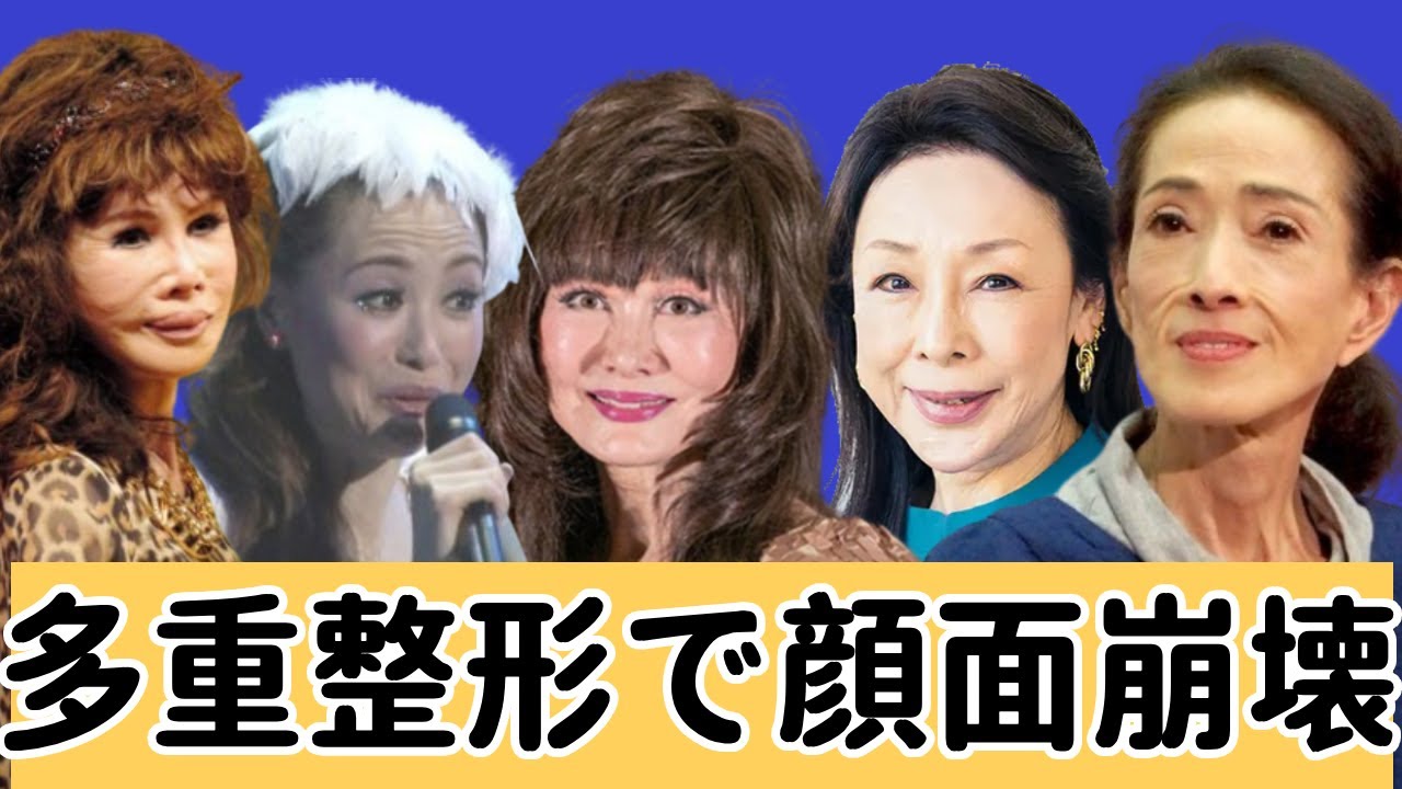 多重整形で顔面崩壊した女性芸能人達【閲覧注意】