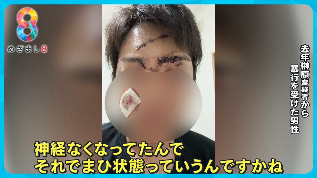 【独自】榊原容疑者に酒瓶で突然殴られ20針…被害者告白 元交際相手も語る“凶暴性”【めざまし８ニュース】