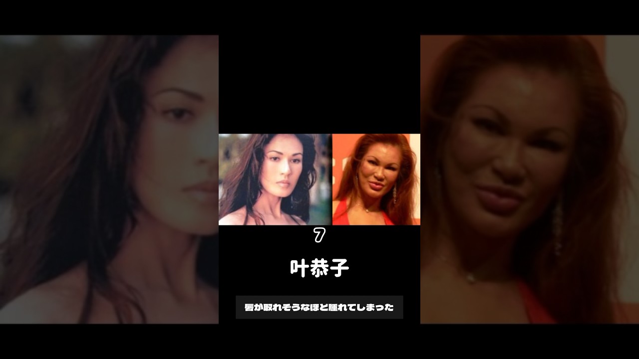 整形に失敗した芸能人10名