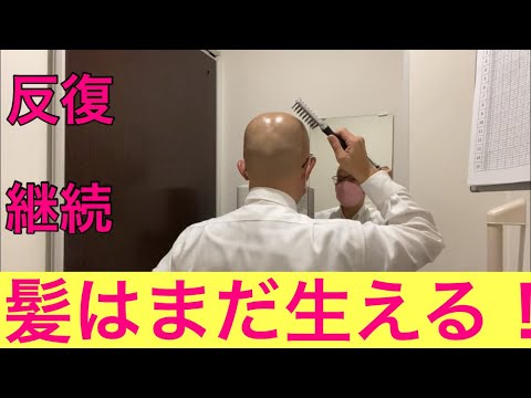 【柴犬飼い主54歳】おじさんでも髪ほしい！