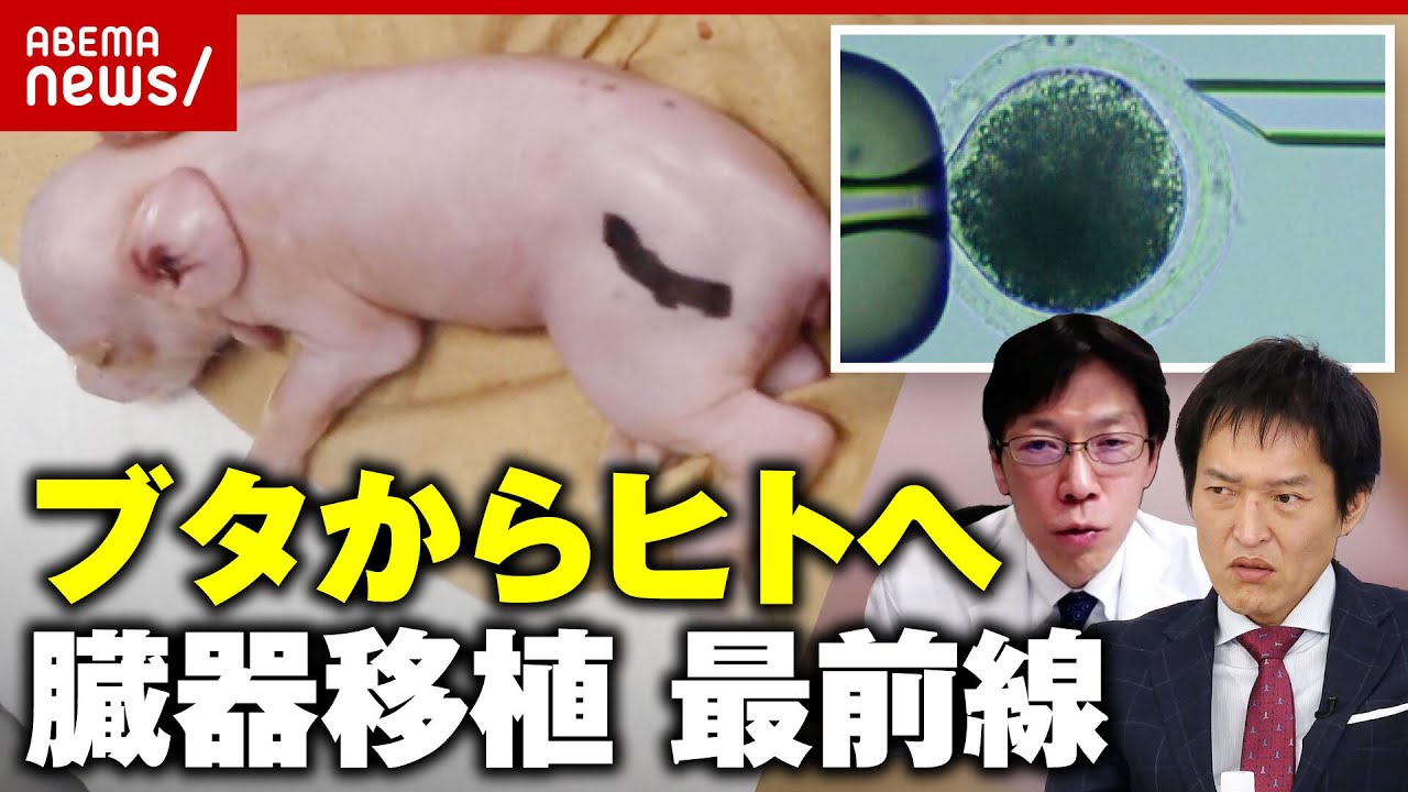 【ブタからヒトへ】「ドナー臓器として現実味を帯びてきた」そもそもなぜブタ？胎児間の腎臓移植の研究も…"異種移植"最前線｜ABEMA的ニュースショー